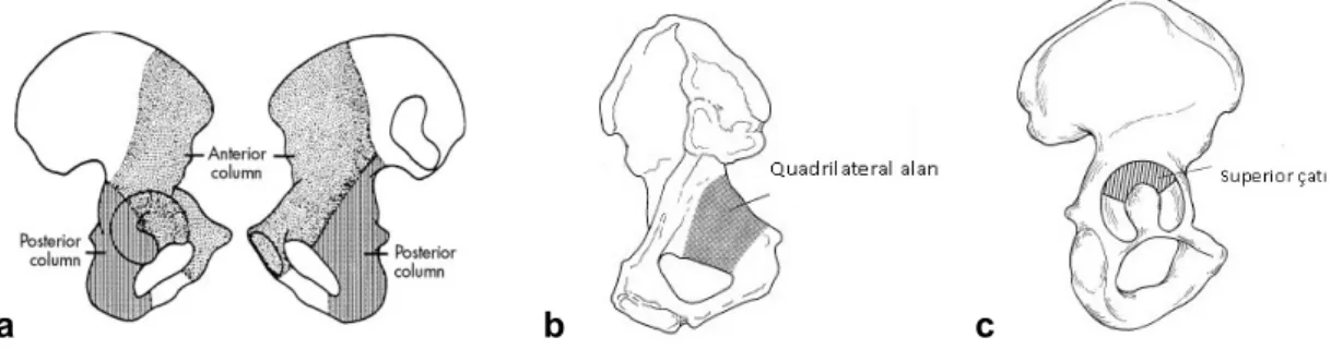 Şekil 7:  a. ön ve arka kolonlar    b. Quadrilateral alan    c. Asetabuler çatı