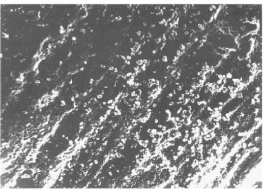 Şekil  2.2.  KSF  ortamında  bakteri  hücreleri  ile  fermente  olmuş  buğday  kepeğinin  elektron  mikroskobundaki  görünümü  (fibriller  içindeki  hidrolize  olan  nişastaya  bakınız)  31-33 
