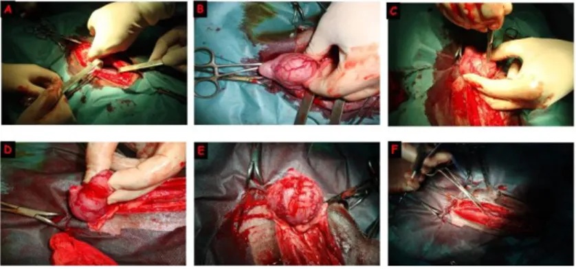 Şekil  4.  Sistotomi  operasyon  aşamaları.  A-Karın  boşluğunun  açılması,  B-İdrar  kesesinin  görülmesi,  C-