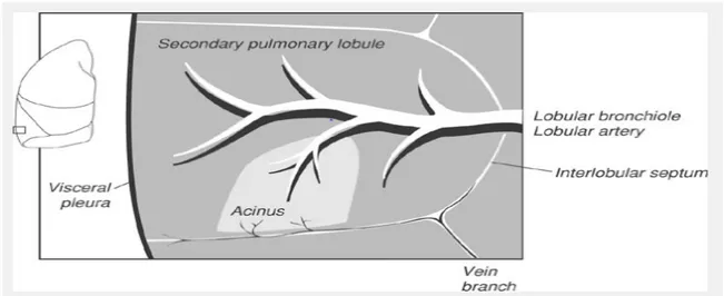 Şekil   1.  Sekonder   pulmoner   lobül:   Sekonder   pulmoner   lobül   polihedral   şekilli, konnektif doku septası (inter lobüler septa) ile çevrilmiş akciğer parankiminin en küçük ünitesidir [22].