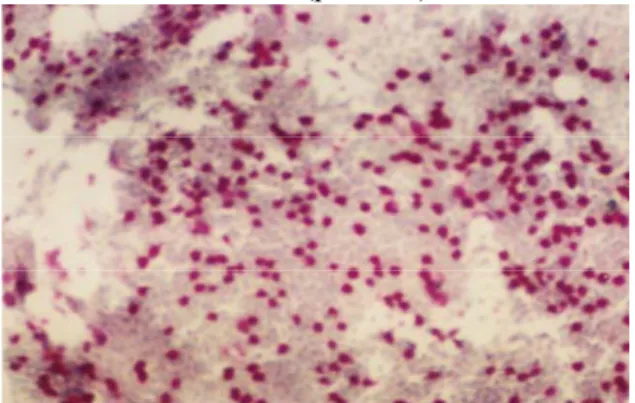 Figure 1. Grade 0 differentiation of 