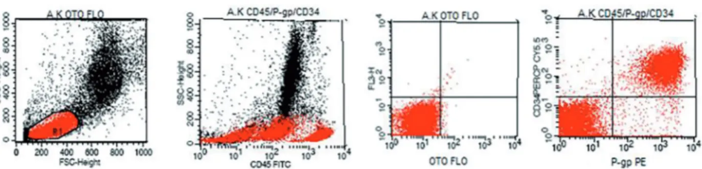 Figure 3. Expression of P-gp and CD34 in a participant of ALL group