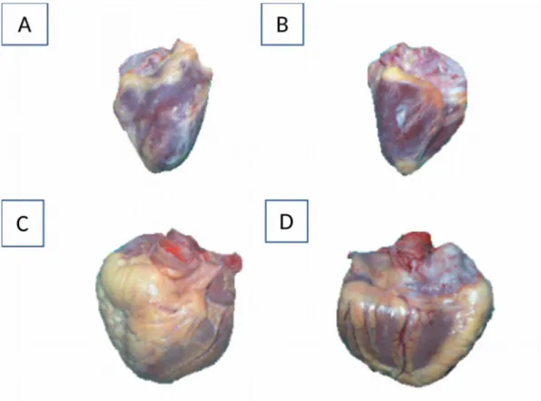 Şekil 2:Epikardiyal yağ dokusunun makroskopik görünümü A: Normal kalbin anterior