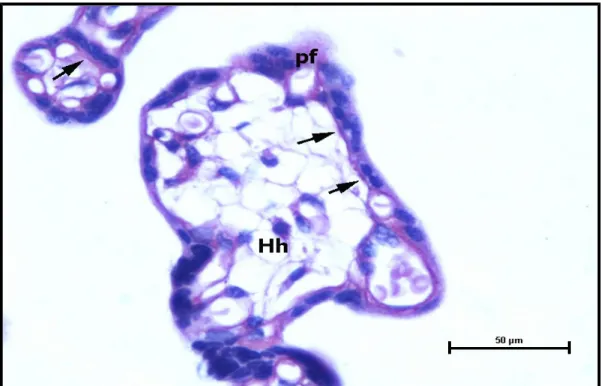 Şekil 9: Kontrol grubu santral plasenta kesitinde, normal kalınlıkta, sağlıklı vaskülosinsityal bazal membranlar (ok), perivillöz fibrin (pf) ve Hofbauer hücreleri(Hh) izlenmektedir