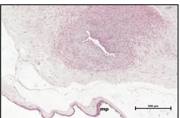 Şekil 13: Preeklampsi grubu, santral plasenta kesiti, amnion epitelinde skuamöz metaplazi (mp) (H-E, Bar: 500μm).