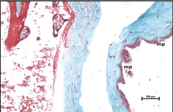 Şekil 26:  Preeklampsi grubu santral plasenta kesiti, amnion epitelinde skuamöz metaplazi (mp) (Masson Trikrom, Bar: 100μm).