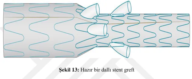 Şekil 13: Hazır bir dallı stent greft 