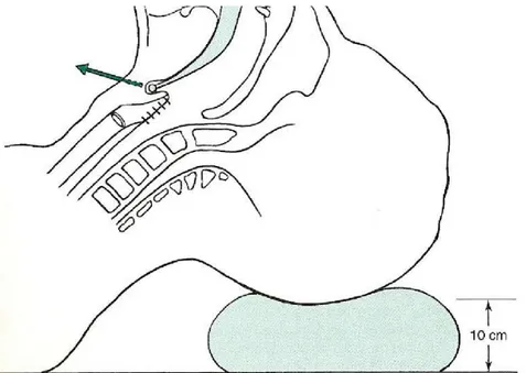 Şekil 4: Larinks girişinin anatomik yapısı