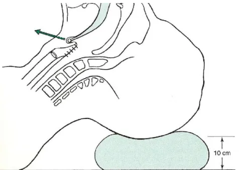 Şekil 4: Larinks girişinin anatomik yapısı