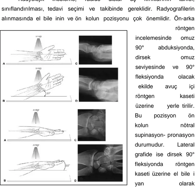 Şekil 21: El bileğinin gerçek anteroposterior ve lateral grafileri