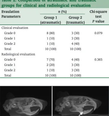 Figure 3 : Cephalometric X-ray showing no lesion in the control 