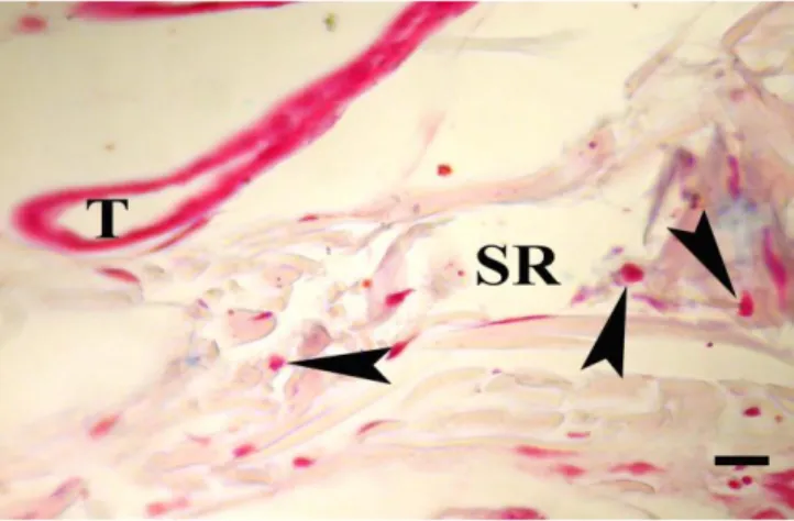 Şekil  5:  Süt  grubuna  ait  izlenimde  stratum  retikülarede  (SR)  ve  ter  bezi  akıtıcı  kanalı  (T)  çevresinde  mast 
