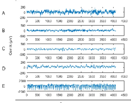 Şekil 1. A,B,C,D ve E kümelerinden alınan EEG  işaretlerinin  örnek  sayısı  (adet) ve genlik  (µV)  gösterimi  