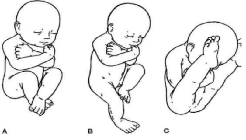 ġekil 1: Prenatal pozisyonlar