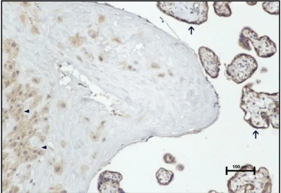 Şekil 15: Kontrol grubu santral kesitte bazal plak desidua hücrelerinde (ok başı) zayıf düzeyde ekspresyon, koryon villüs sinsityotrofoblastlarında (oklar) orta düzeyde ekspresyon görülmekte (MMP-2 immün boyama, Bar çubuğu:100μm).