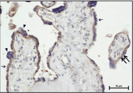 Şekil 21: Kontrol grubu perifer kesitte bazal plak desidual hücrelerde (oklar) zayıf düzeyde ekspresyon izlenmektedir (MMP-2 immün boyama, Bar: 20 μm ).