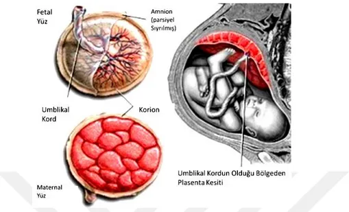 Şekil  1:Plasentanın  maternal  yüz,  fötal  yüzü,  umblikal  kord,  koriyon  amniyon  zarının    şematik 