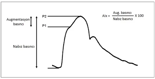 Şekil 3.2-4: Nabız dalgasında augmentasyon basıncının şematik gösterimi (Kaynak 72’den uyarlanmıştır)