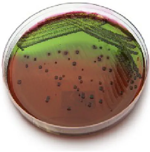 Şekil 1: EMB agarda metalik refle yapan E.coli kolonileri