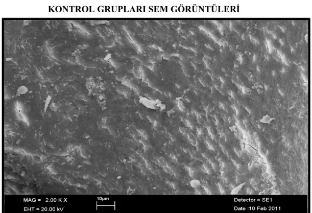 Şekil   9.  El   aleti/NaOCl/Apikal   bölge   SEM   görüntüsü.  Yoğun,   homojen   smear