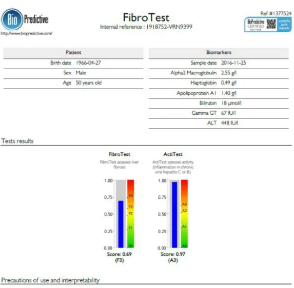 Şekil 10. FibroTest sonuç örneği. 