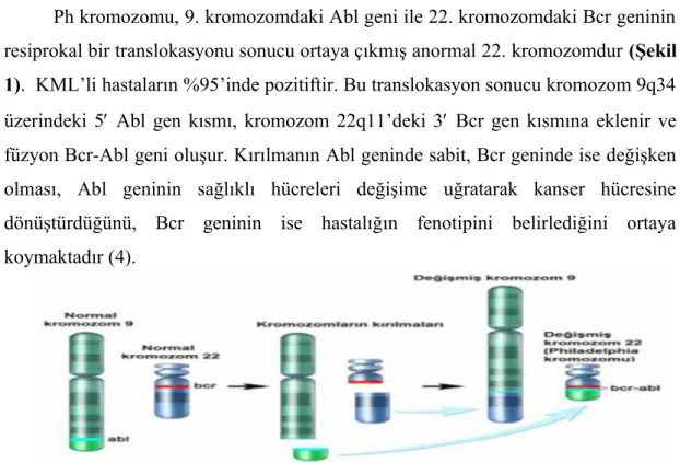 Şekil 1: 9.kromozom ile 22. kromozom arasındaki karşılıklı translokasyon ve Ph 