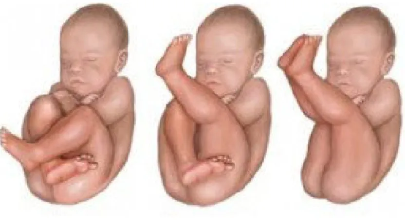 Şekil 1: Prenatal pozisyonlar