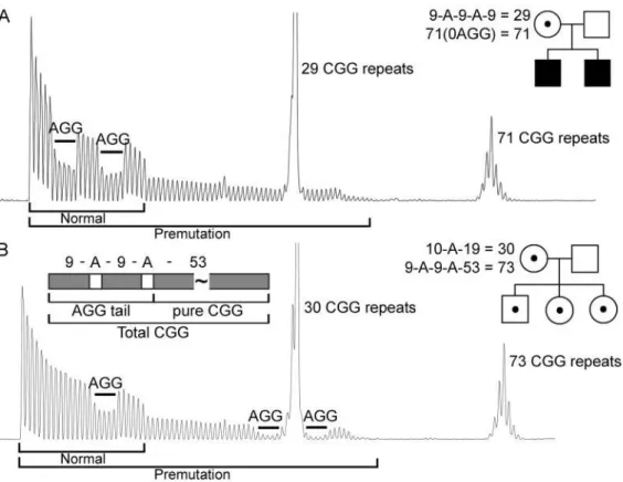 Şekil 5: İki kadın premutasyon taşıyıcısı için CGG-tekrar içeren PCR ürünlerinin elektro-ferogram modellerinin örnekleri, biri normal alelde 2 AGG kesintisi olan (29 CGG tekrar) ve premutasyon alellinde AGG içermeyen (71 CGG tekrarlar) (A) ve biri normalde