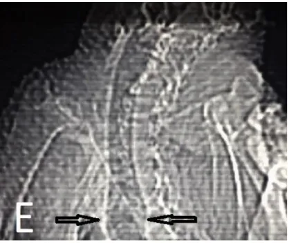 Şekil 3. E: Trachea’nın 2D ventral’den görünümü; Ok: Thoracal caudal noktada genişleme alanı