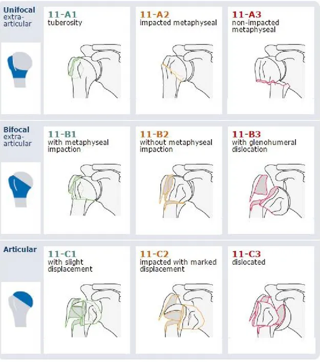 Şekil 17. AO Sınıflaması