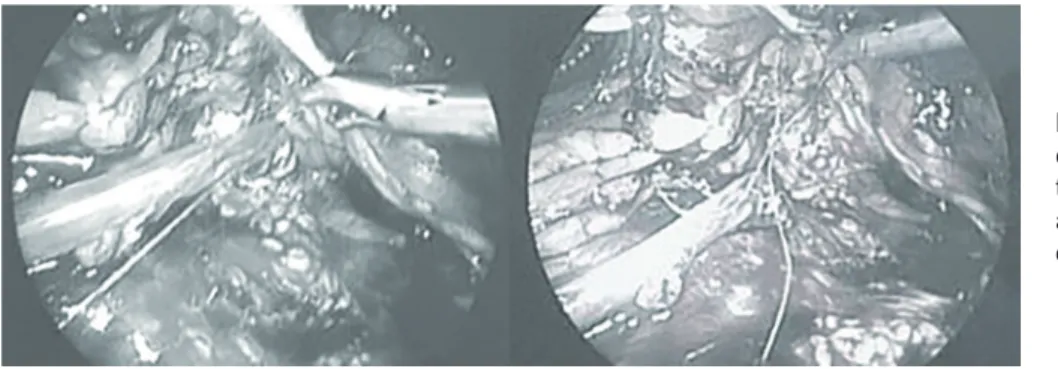 Figure 3.  Dismembered  py-