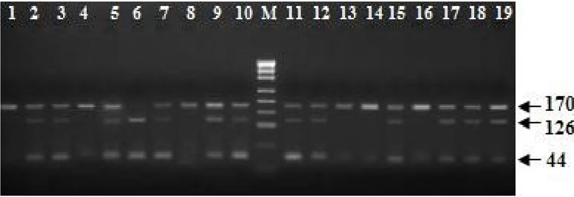 Şekil 8. PON1 L55M için PCR-RFLP enzim kesim sonuçları