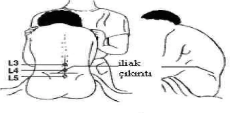 Şekil 9: Oturur pozisyon (36) 