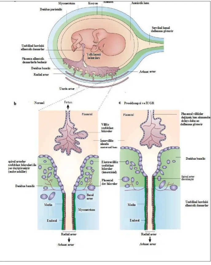 Şekil  1.  Trofoblast   hücre   invazyonu   yetersiz   olduğunda   spiral   arterlerin   eksik transformasyonu oluşur