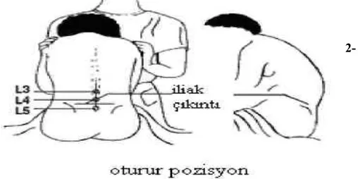 Şekil 9: Oturur pozisyon (61)