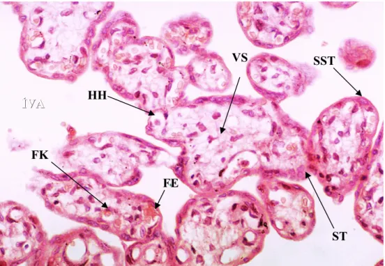 Şekil   1:  Kontrol   grubu   plasenta   görünümü.   Terminal   villusların   enine   kesitleri, sinsityotrofoblastlar (SST), sitotrofoblastlar (ST), villus stroması (VS), stromadaki Hofbauer hücreleri (HH), fetal kapillerler (FK), fetal eritrositler (FE) 