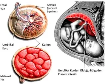 Şekil 1: Plasentanın maternal yüzünün, fetal yüzünün, umblikal kordun, koryon ve amniyon zarlarının 