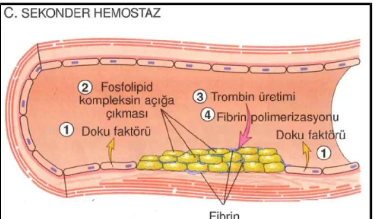 Şekil 15. Sekonder Hemostatik Tıkaç (31)