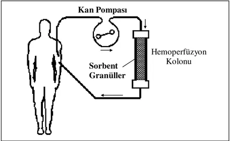 Şekil 2. 11. Genel bir hemoperfüzyon şeması 