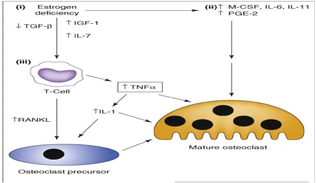 Şekil 3.(68) Östrojen eksikliğinin osteoklastik kemik yıkımındaki rolü. Östrojen düzeyindeki azalma Transforming growth factor-β (TGF-β) düzeyindeki  azalma ve interlökin-7 (IL-7), insulin like growth factor-1 (IGF-1)  düzeyindeki   artışla  ilişkilidir