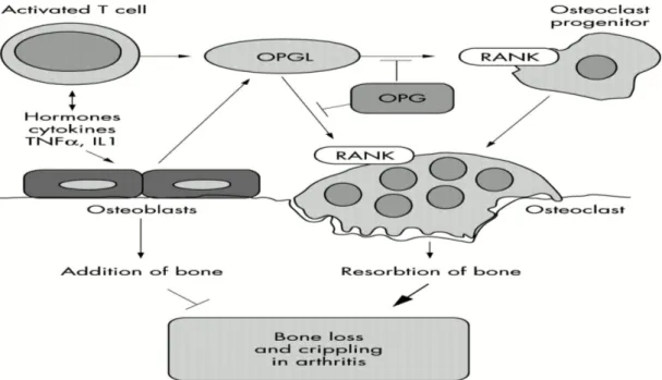 Şekil 4. RA’ te RANK/RANKL/OPG nin kemik yıkımı ile ilişkisi (92)