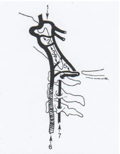 Şekil 4 Persistan fetal karotid-vertebrobaziler anastomozlar