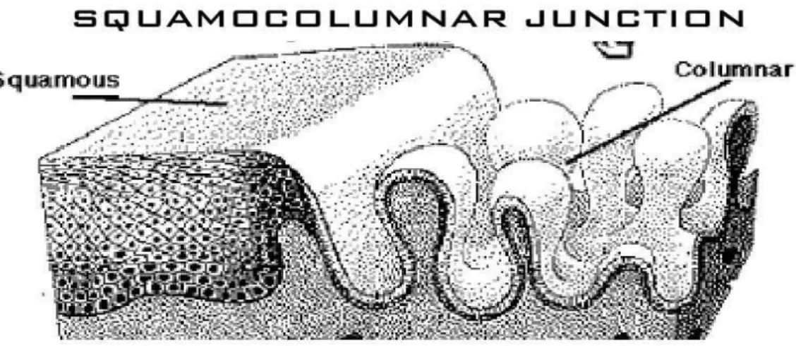 Şekil 3 : Squamocolumnar Junction