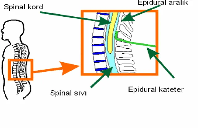 Şekil 11:Epidural ve spinal aralık 