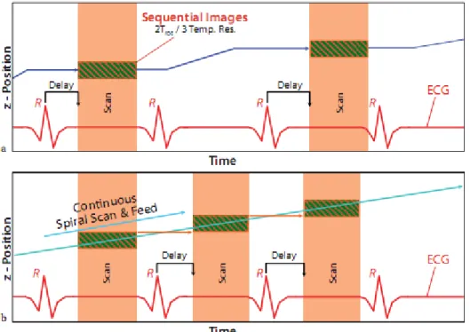 Şekil 2. (a) Prospektif EKG tetiklemeli tek kesit tarama ile sekansiyal volüm kapsamı ve (b) retrospektif EKG-gated tek kesit spiral tarama ile kapsam