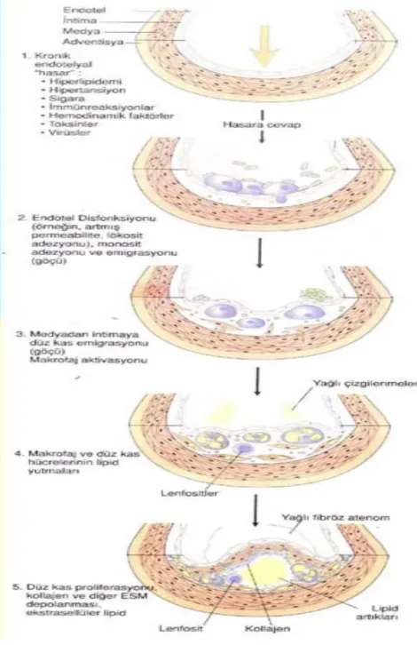 Şekil 7: Aterogenezin hasara-cevap teorisi