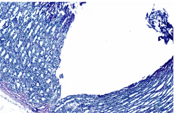 Şekil   4.  Ülser   Grubu;   sıçan   mide   kesitinde   parsiyel   mukoza   kaybı   ve   mukus birikiminde   azalma   görünümü
