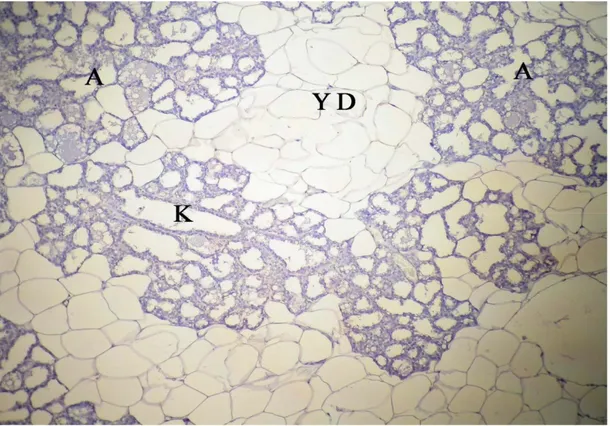 Şekil 4.5. İmmunohistokimyasal boyanmanın görülmediği negatif kontrol, A: alveol,  K: duktus laktiferus, YD: yağ doku, Gill Haematoksilen X10 