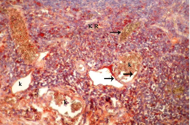 Şekil 4.7. Meme lenf düğümünün korteksinde yerleşen bazı hücrelerde ve damar  endotellerindeki VEGF lokalizasyonu, KR: korteks, k: damar, endotel hücreleri (ok),  X40