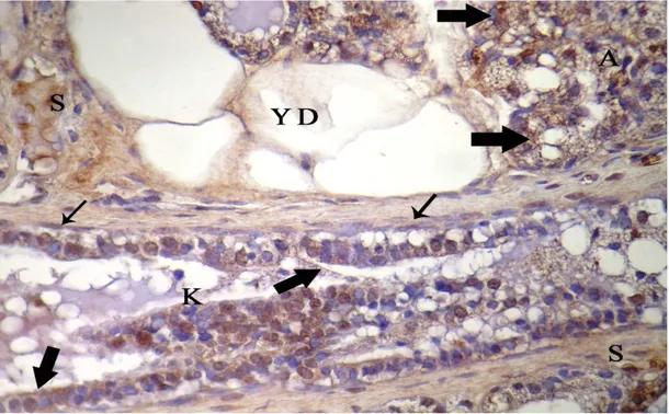 Şekil 4.10. Gebeliğin 21. günündeki sıçan memesinde erbB1 lokalizasyonu, A:  alveol, K: kanal, YD: yağ dokusu, S: bağdoku, alveol ve kanal epiteli (kalın ok),  damar endoteli (ince ok), X40 